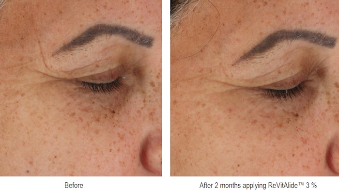 As a green, biodegradable and more efficient application of retinol, Revitalide reinforces delivery into the skin while the capsule protects the retinol, ensuring a sound delivery.