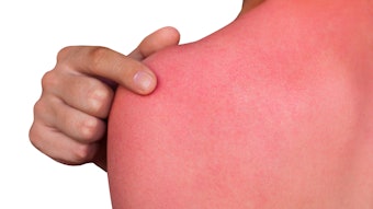 DSM has gained the support of 11 U.S congress members in order to change the ruling of sunscreen as a 'weather-related' protector into a more broad definition in order to require employers to provide sunscreen for employees.