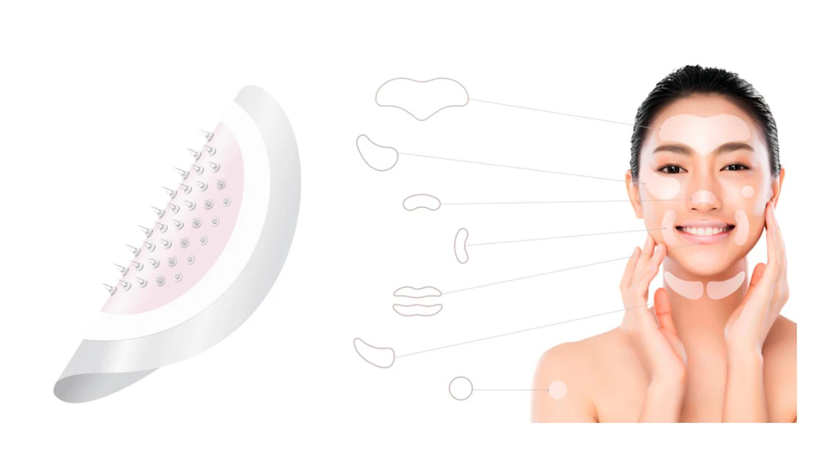 New Tech Alert: Dissolvable Microneedle Patches for Acne, Wrinkles & More - Vimarsana News