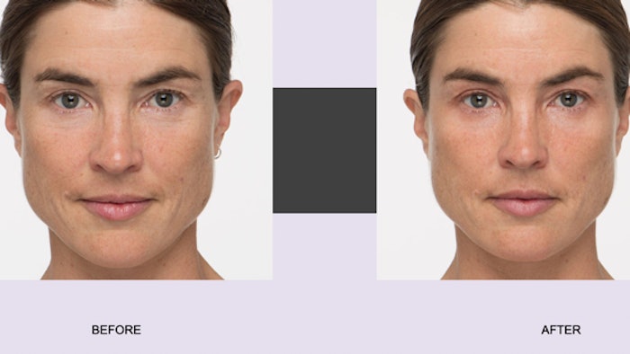 Beforeandafterphoto1