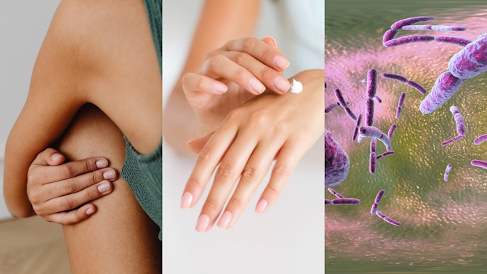 Where is microbiome beauty going next? A forthcoming talk will explore what's next.