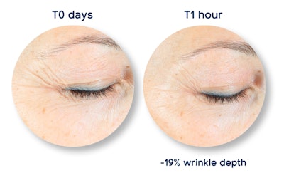 Lipotrue Ct2210 Image1