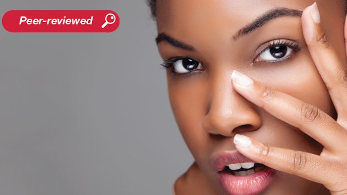 Metagenomics analysis has revealed that dysbiosis of the skin microbiome underlies the development of acne. As such, a polylysine dendrimer was developed to modulate the skin microbiome and restore homeostasis as an anti-acne strategy.