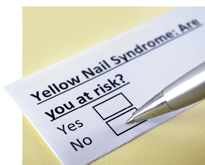 Experts share the signs and symptoms of Yellow Nail Syndrome.