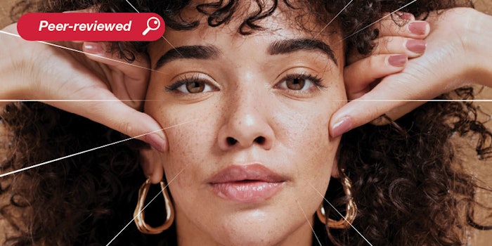 This article explores detachable microneedles applied via patches as a means to deliver bioactive ingredients. Tests were performed in porcine skin, a silicone model and human volunteers for potential irritation and clinical anti-aging efficacy.