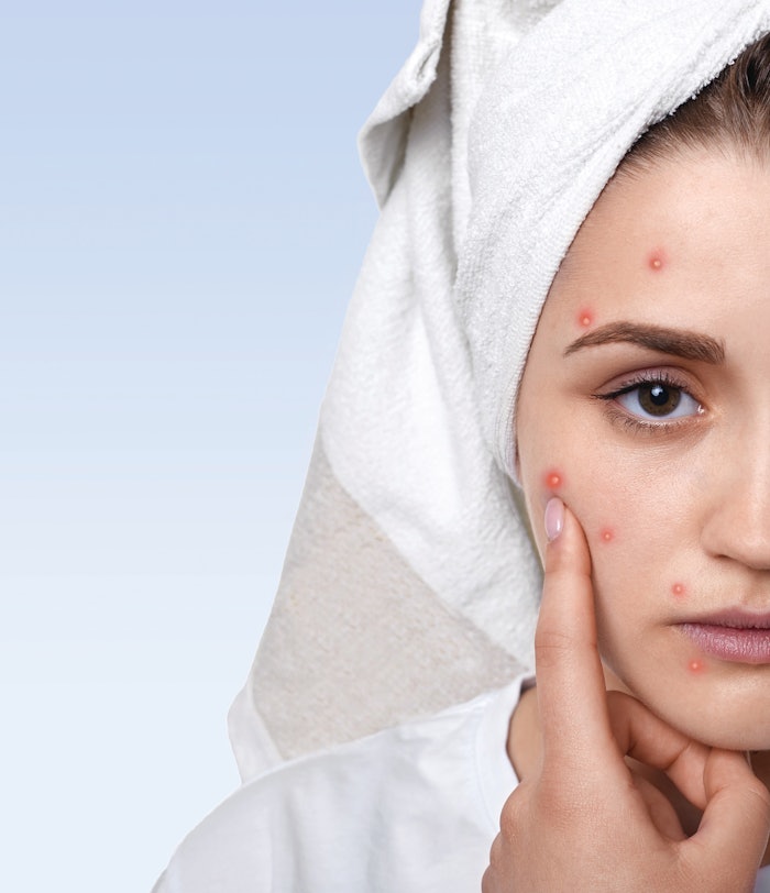 Icsc Cosmosil Oil Control