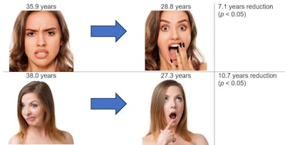Figure 5. Change in perceived age