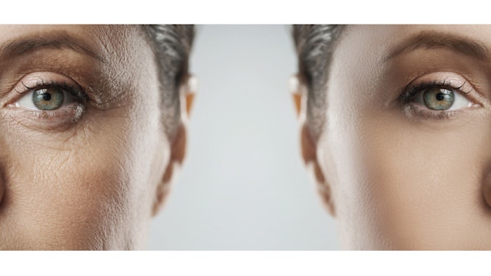 How to Educate Clients About Physiological Signs, Causes and Solutions of Aging