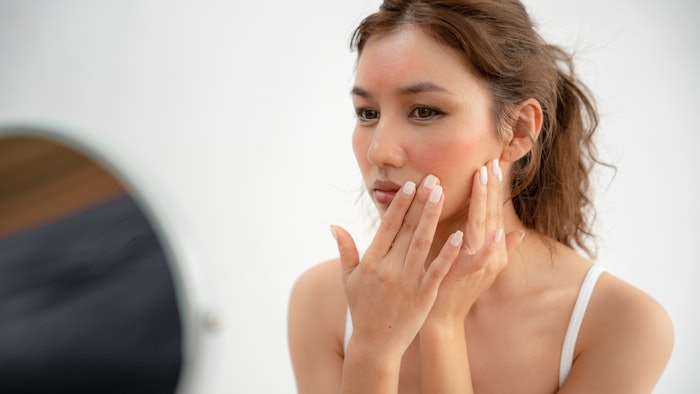 Woman with sensitive skin