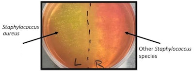 Figure 1. Mannitol salt agar plate incubated with swabs from the nares (nostrils) of an individual with S. aureus growth for the left side and non-S. aureus species growth on the right
