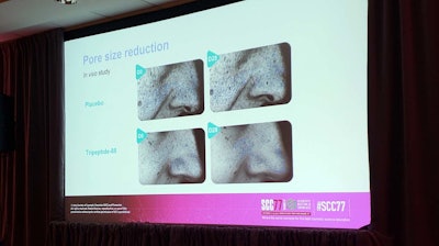 Mussi concluded that tripeptide-85 could balance and mattify oily skin and visibly minimize pore size.