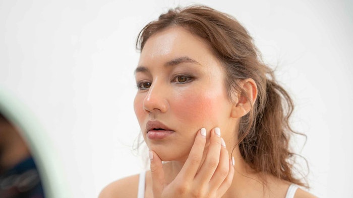 Dermatologists view sensitive skin as characteristic of all skin diseases. Common conditions that embody sensitive skin include eczema, atopic dermatitis, seborrheic dermatitis, rosacea, cosmetic intolerance syndrome and psoriasis.