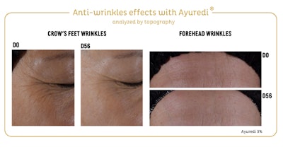 Sized Additional Graphic