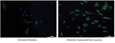 Ct2406 Dsm Advertorial Figure6