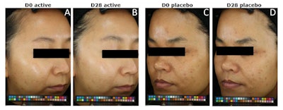 Ct2410 Meunier Figure9