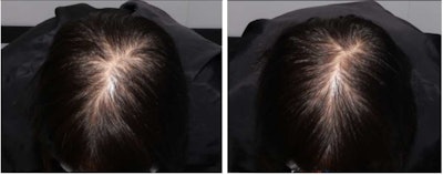 Ct2410 Yang Figure 2