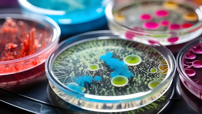 petri dishes microbe testing colorful spread out on surface