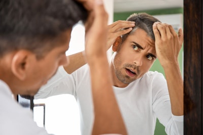 Man Looking In Mirror Worried Scalp Adobe Stock 400694035 (1)