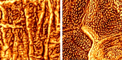 (from L) Examples of healthy skin and atopic dermatitis imaging under AFM