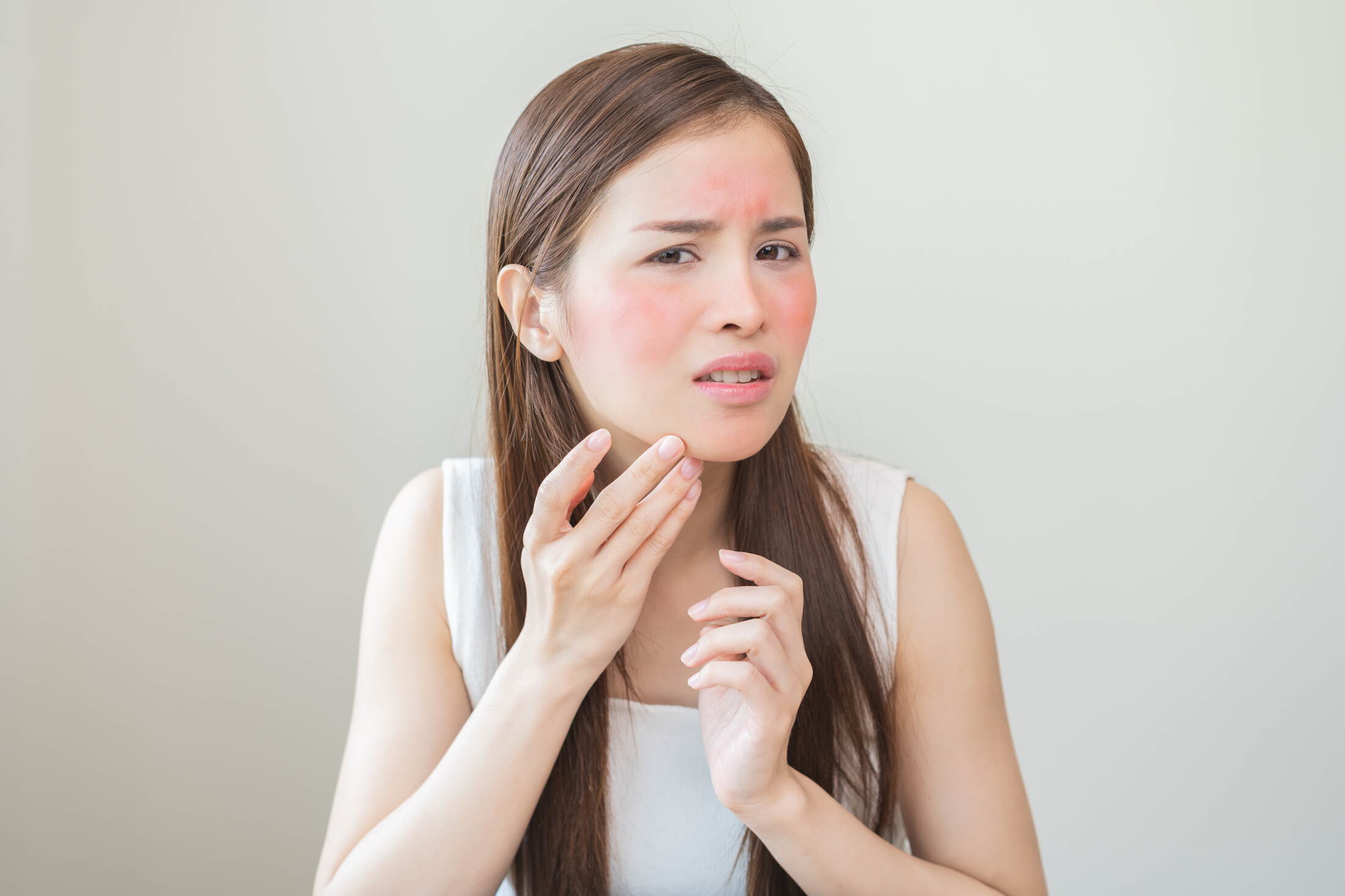 Woman With Itchy Red Skin Irritated Hurt Red Adobe Stock 1096675647