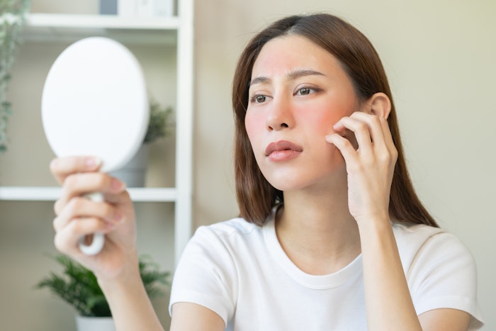 Results suggested the ingredient increases natural antioxidant defenses to reduce cellular oxidative stress, inhibits one of the main proinflammatory pathways, and ultimately breaks the oxi-inflammatory loop generated by environmental aggressions at the lipid level.