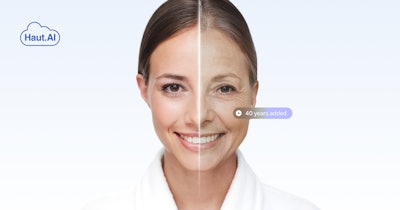 Through Haut.AI's SkinGPT, users can see how lifestyle choices (including diet, exercise and skin care) can alter skin’s texture and tone, highlighting the relationship between beauty and wellness to motivate healthier, life-long choices.