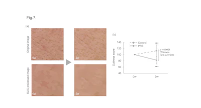 Skin Root Comprehensive Benefits of Peony Root Extract for Even-toned and Radiant ...