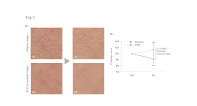 Figure 7 - PRE improves skin dullness.
