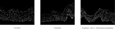 Figure 2 - Representative images of ZO-1 staining in skin explants: untreated (left), treated with cortisol (middle) or treated with cortisol + 3% L. rhamnosus postbiotic (right).