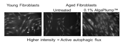 Figure 1 - Effect of PCE on autophagic flux in an aged NHDF culture, vs. aged untreated and young NHDF controls (illustrative microscopy images).