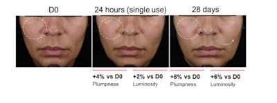 Figure 3 - Visible improvements of skin plumpness and luminosity after 24 hours and 28 days of application of 1% PCE, two times per day. Volunteer #31; age 47.
