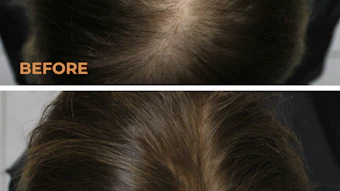 Core Biogenesis June Pru