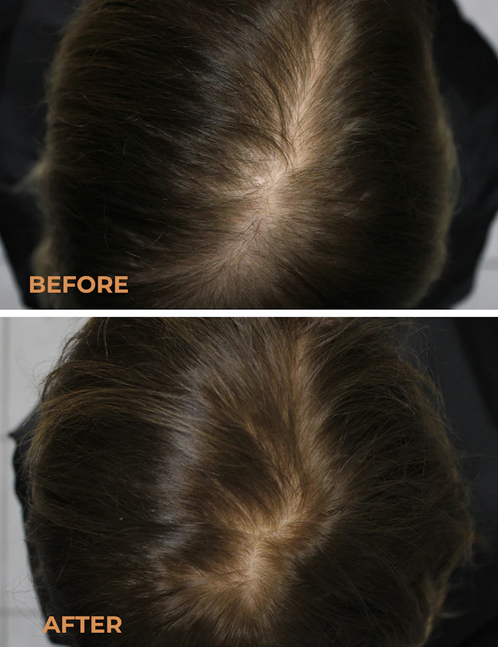 Core Biogenesis June Pru