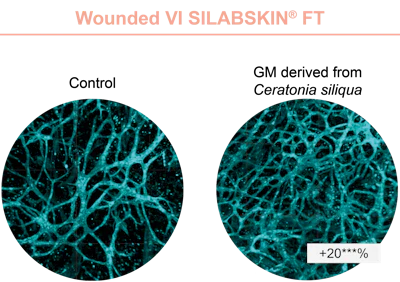 Figure 2 - Effect of GM derived from Ceratonia siliqua on the vascularization observed on wounded VI SILABSKIN FT.