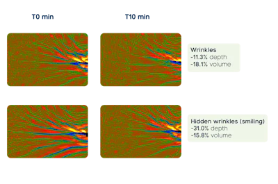 Additional Graphic Element