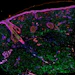Genemarkers Ja Roundup