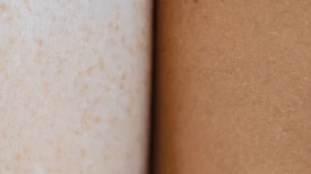 Close-up comparison of two different skin tones side by side showing diversity
