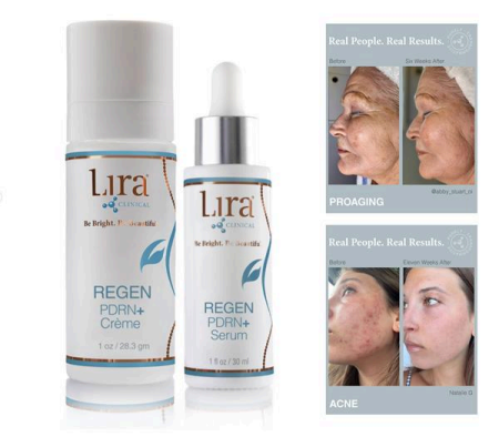 Lura skincare products with before-and-after results showing proaging and acne treatment benefits